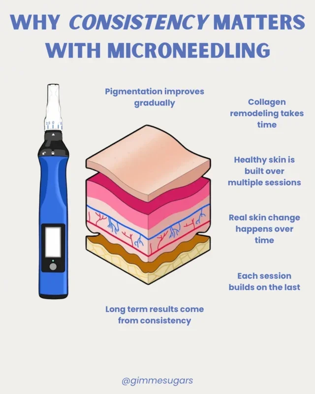 SkinPen a great treatment to rotate in with your skin goals.